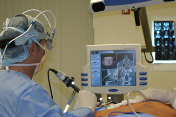 Sinus Surgery