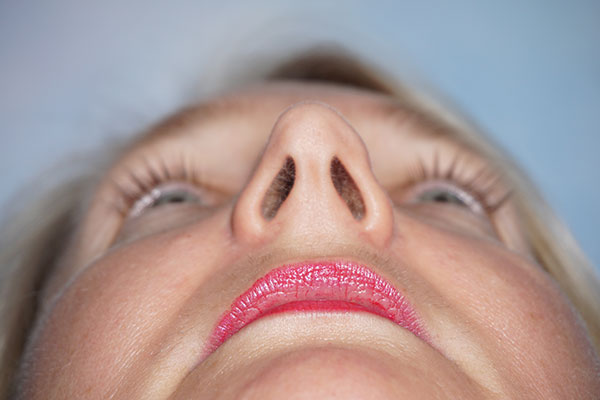 Before Surgery