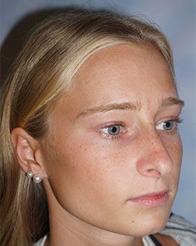 before-angleDDC82BFD-0980-543E-83C0-352B5D4F01BB.jpg