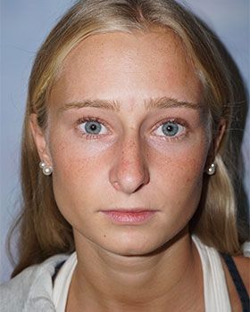 before-front7ABD3784-08F6-F10C-A61F-200EE7C8937A.jpg
